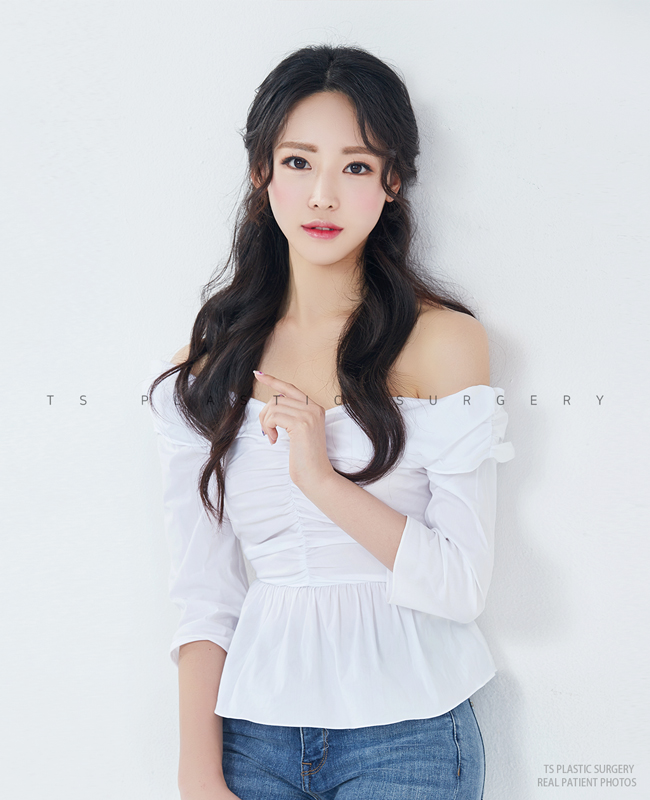 TS Plastic Surgery, Real Patient photos