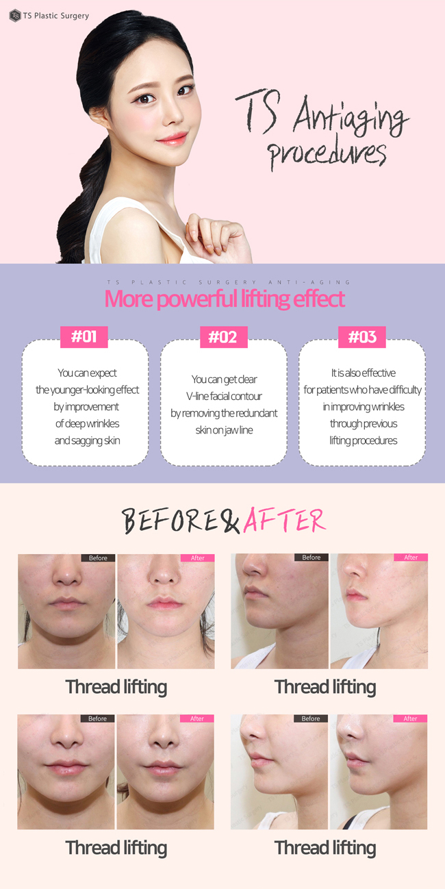 TS Plastic Surgery's antiagin procedures