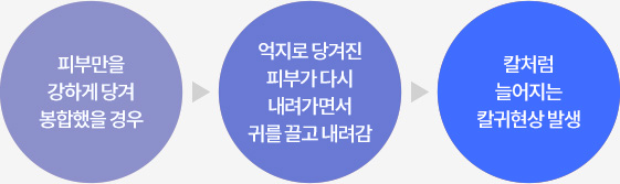 피부만을 강하게 당겨 봉합했을 경우 > 억지로 당겨진 > 피부가 다시 내려가면서 귀를 끌고 내려감 > 칼처럼 늘어지는 칼귀현상 발생
