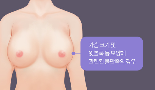 가슴 크기 및 윗볼록 등 모양에 관련된 불만족의 경우