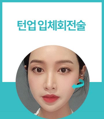 티에스 입체회전술