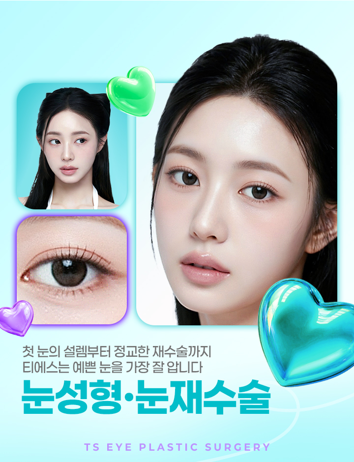 티에스 눈코재수술