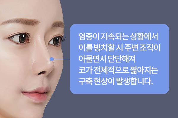 염증이 지속되는 상황에서 이를 방치할 시 주변 조직이 아물면서 단단해져 코가 전체적으로 짧아지는 구축 현상이 발생합니다.
